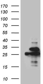 PGAM4 Antibody in Western Blot (WB)