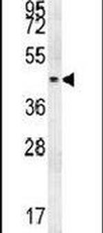 PGAP2 Antibody in Western Blot (WB)