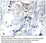 PGAP3 Polyclonal Antibody