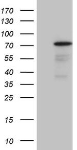 PGBD3 Antibody in Western Blot (WB)