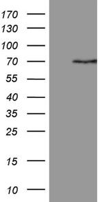 PGBD3 Antibody in Western Blot (WB)