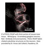 PGCG Polyclonal Antibody
