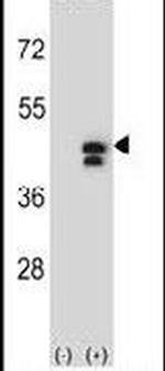 PGK1 Antibody in Western Blot (WB)
