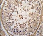 PGK2 Antibody in Immunohistochemistry (IHC)