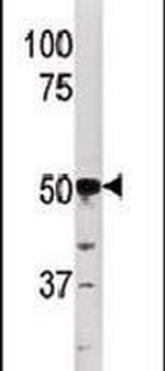 PGK2 Antibody in Western Blot (WB)