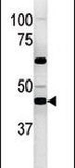 PGK2 Antibody in Western Blot (WB)