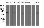 PGM3 Antibody in Western Blot (WB)