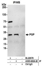 PGP Antibody in Western Blot (WB)