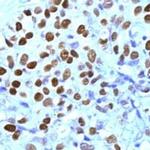 Progesterone Receptor Antibody in Immunohistochemistry (IHC)