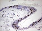 PGR Antibody in Immunohistochemistry (Paraffin) (IHC (P))
