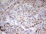 PGR Antibody in Immunohistochemistry (Paraffin) (IHC (P))
