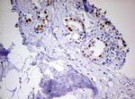PGR Antibody in Immunohistochemistry (Paraffin) (IHC (P))