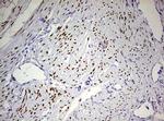 PGR Antibody in Immunohistochemistry (Paraffin) (IHC (P))