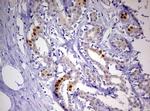 PGR Antibody in Immunohistochemistry (Paraffin) (IHC (P))