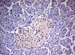 PGR Antibody in Immunohistochemistry (Paraffin) (IHC (P))