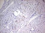 PGR Antibody in Immunohistochemistry (Paraffin) (IHC (P))
