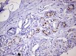 PGR Antibody in Immunohistochemistry (Paraffin) (IHC (P))