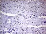 PGR Antibody in Immunohistochemistry (Paraffin) (IHC (P))