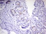 PGR Antibody in Immunohistochemistry (Paraffin) (IHC (P))