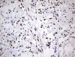 PGR Antibody in Immunohistochemistry (Paraffin) (IHC (P))
