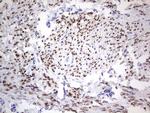 PGR Antibody in Immunohistochemistry (Paraffin) (IHC (P))