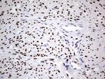 PGR Antibody in Immunohistochemistry (Paraffin) (IHC (P))