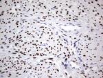 PGR Antibody in Immunohistochemistry (Paraffin) (IHC (P))
