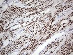 PGR Antibody in Immunohistochemistry (Paraffin) (IHC (P))