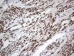 PGR Antibody in Immunohistochemistry (Paraffin) (IHC (P))
