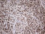 PGR Antibody in Immunohistochemistry (Paraffin) (IHC (P))