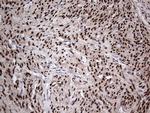 PGR Antibody in Immunohistochemistry (Paraffin) (IHC (P))