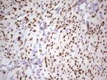 PGR Antibody in Immunohistochemistry (Paraffin) (IHC (P))