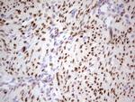 PGR Antibody in Immunohistochemistry (Paraffin) (IHC (P))