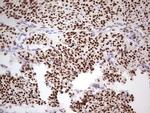 PGR Antibody in Immunohistochemistry (Paraffin) (IHC (P))