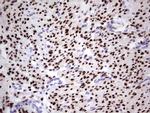 PGR Antibody in Immunohistochemistry (Paraffin) (IHC (P))