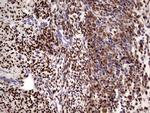 PGR Antibody in Immunohistochemistry (Paraffin) (IHC (P))