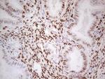 PGR Antibody in Immunohistochemistry (Paraffin) (IHC (P))