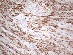 PGR Antibody in Immunohistochemistry (Paraffin) (IHC (P))