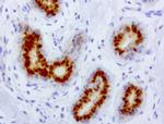 PGR Antibody in Immunohistochemistry (Paraffin) (IHC (P))