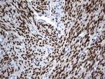 PGR Antibody in Immunohistochemistry (Paraffin) (IHC (P))