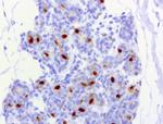 PGR Antibody in Immunohistochemistry (Paraffin) (IHC (P))