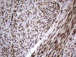 PGR Antibody in Immunohistochemistry (Paraffin) (IHC (P))