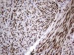 PGR Antibody in Immunohistochemistry (Paraffin) (IHC (P))