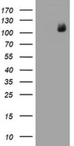 PGR Antibody in Western Blot (WB)