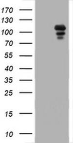 PGR Antibody in Western Blot (WB)