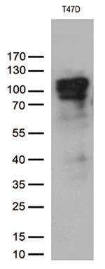 PGR Antibody in Western Blot (WB)
