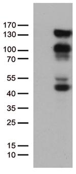 PGR Antibody in Western Blot (WB)