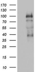 PGR Antibody in Western Blot (WB)