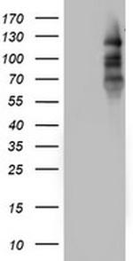 PGR Antibody in Western Blot (WB)