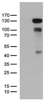 PGR Antibody in Western Blot (WB)